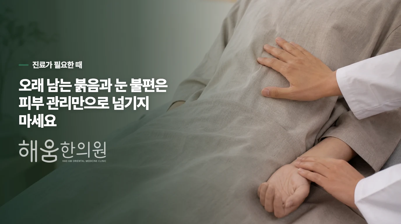 붉음이 오래 남거나 눈까지 불편하면 피부를 평가받으세요