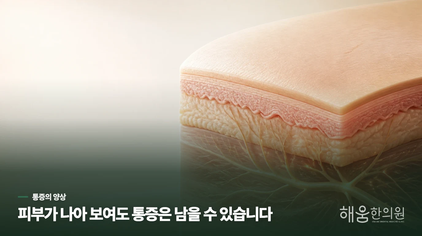발진이 가라앉아도 통증이 남는 이유