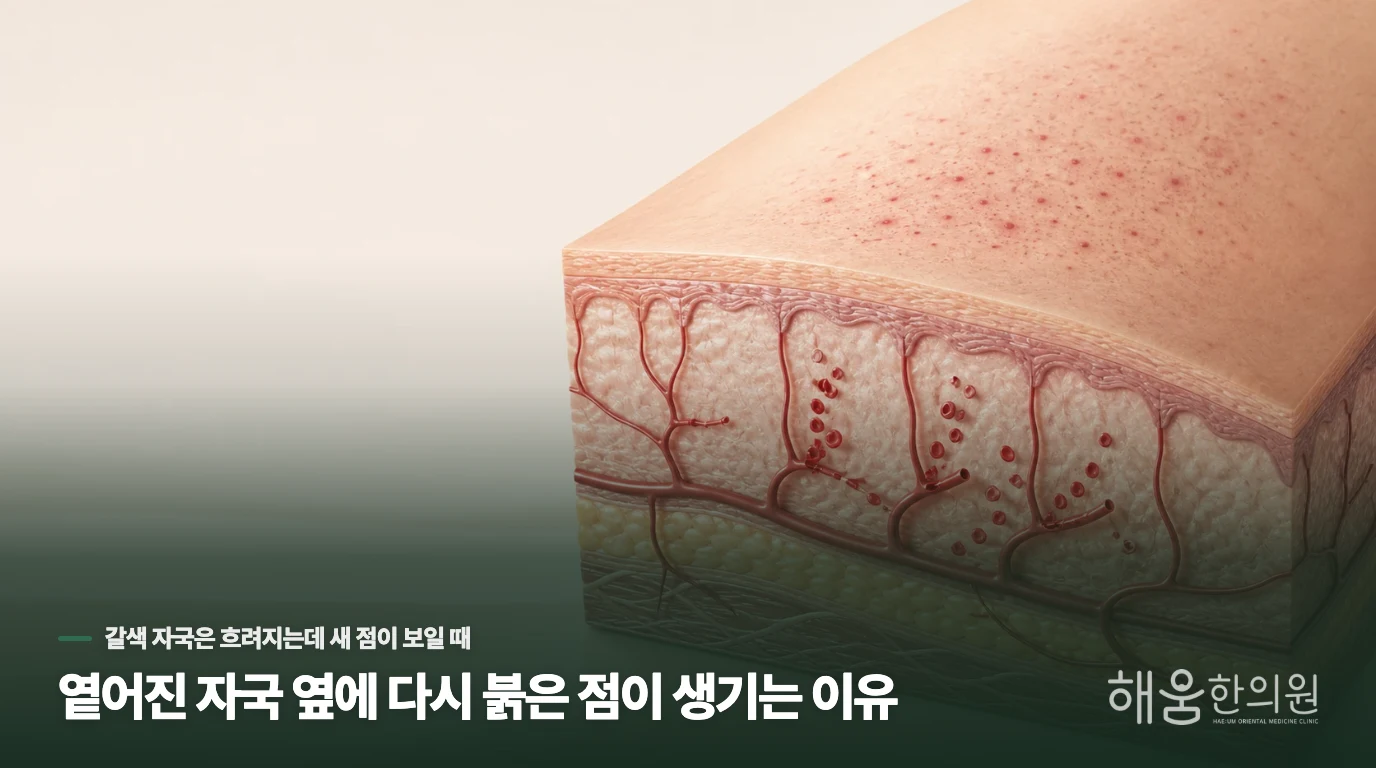 옅어진 자국 옆에 다시 붉은 점이 생기는 이유