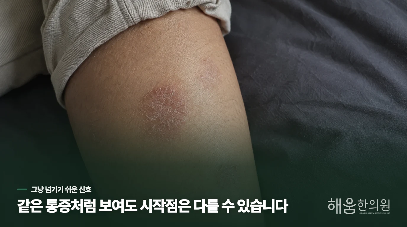 커짐·진물·통증이 이어지면 진료를 받으세요